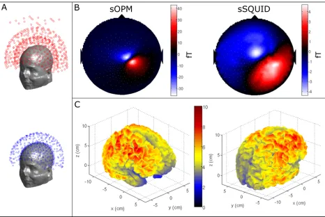 Fig 3 shows the results of our SNR measurements.inner shell of detectors is placed just 4 mm from the scalp surface.netic fields (i.e