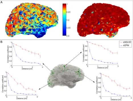 Fig 4. Reconstruction accuracy. (A) The left hand panel shows beamformer reconstruction accuracy for the sSQUID system