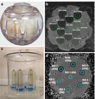 Fig. 2 Test-objects for QualityAssurance in diffusion-weightedimaging: Spherical PVP phantomproduced by QIBA and NIST (A)and corresponding axial ADCmap (B); Cylindrical PVP phan-tom produced at The Institute ofCancer Research UK and used forEU multicentre 