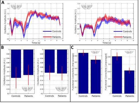 Fig. 7. Alpha band amplitude and connectivity changes in visual cortex. A) Timecourses of alpha band oscillatory envelope in patients (red) and controls (blue)