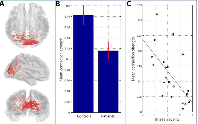 Fig. 6. Visualisation of the differences in alpha band functional connectivity between patients and controls
