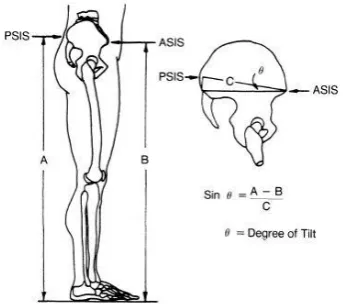 Figure 2: Tester measuring distance between PSIS and floor 