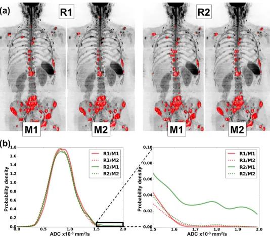 Fig 4. Top row: Coronal maximum intensity projection (MIP) of a patient diagnosed with metastatic breast cancer (b = 900 s/mm2 images)