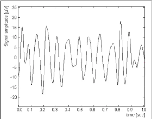 Figure 6: Detail of processed signal given in ﬁgure 5, for a time span of 1 second.