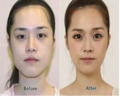 Fig 1 : Plastic surgery images  