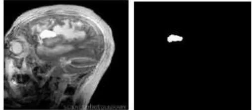 Fig. 1 left: original image, right: Segmented image 