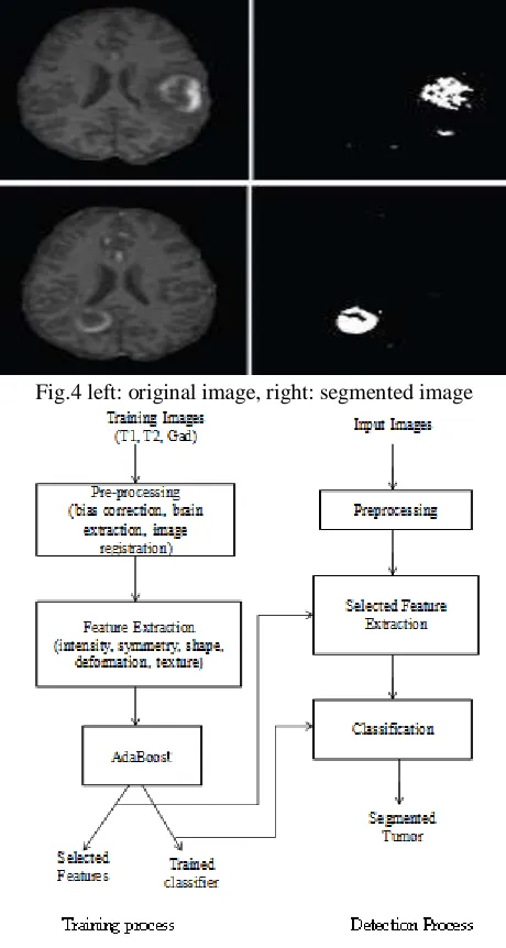 Figure 5: Block diagram of Automatic detection using neural network 