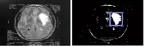 Figure 6: (a) Original Image       (b) Cropped Image  