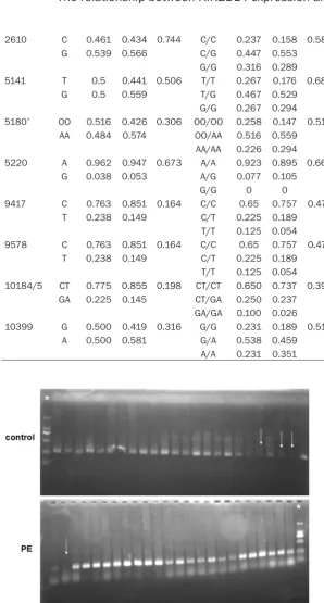 Figure 1. Electrophoretogram of polymerase chain reaction for KIR2DL4. *: molecular weight marker, white arrow: negative for KIR2DL4.