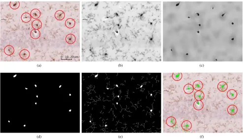 Figure 2. Smoothed microglial cell (a) α=0 (b) α=10 (c) α=20 (d) α=30 (e)α=100 (f) α=200 (g) α=300 (h) α=400.