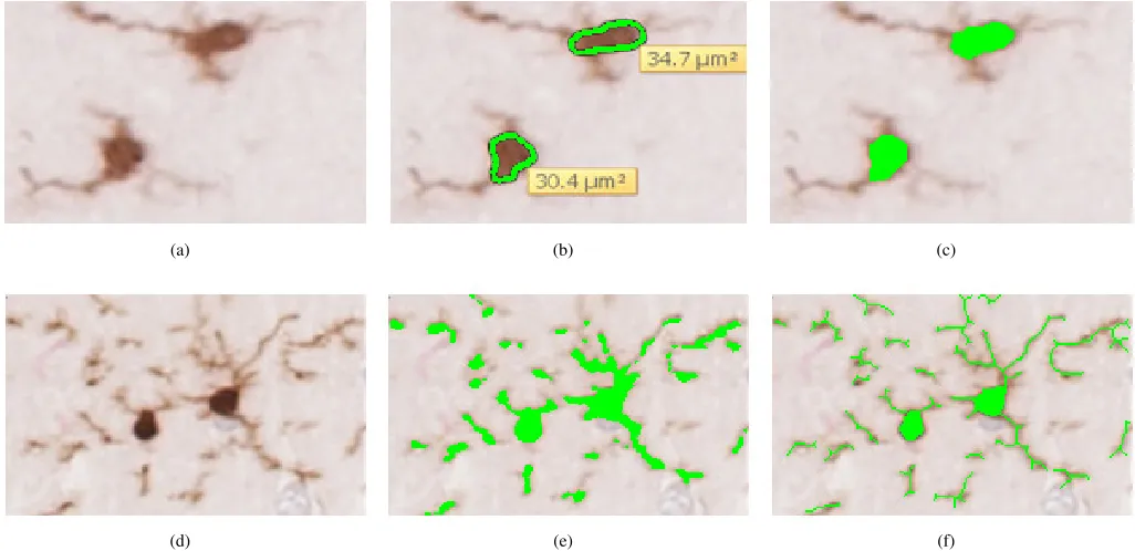 Figure 5. Challenges described in [16(b) Image has a large complex artifact with microglia located partly inside the artifact (c) image shows two regions that exhibit different visual textures (d)] and the proposed method overcomes these problems (a) Image
