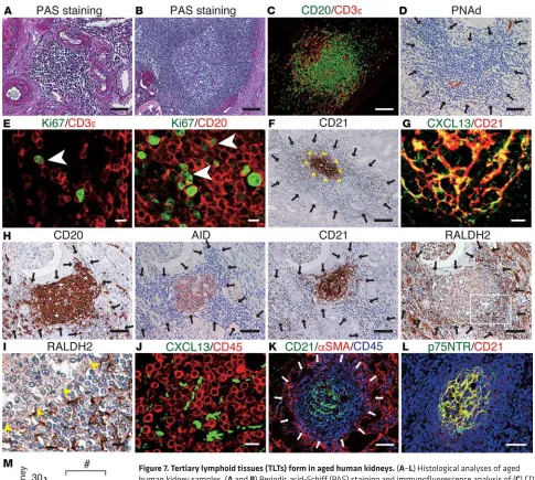 Figure 7. Tertiary lymphoid tissues (TLTs) form in aged human kidneys. (A–L) Histological analyses of aged human kidney samples