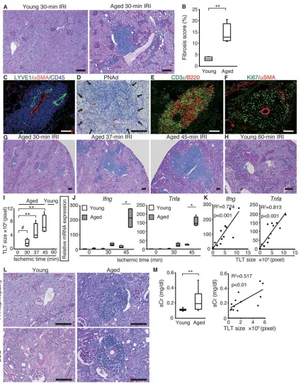 Figure 1. Aged mice develop multiple renal tertiary lymphoid tissues (TLTs) after kidney injury