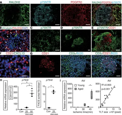 Figure 3. Fibroblasts with distinct phenotypes underlie tertiary lymphoid tissue (TLT) formation in the aged injured kidney.experiments