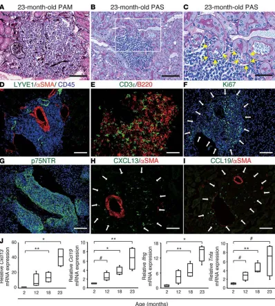 Figure 5. Superaged mice spontaneously develop renal tertiary lymphoid tissues (TLTs) without injury