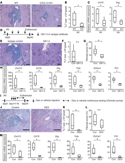 Figure 6. Targeting tertiary lymphoid tissue (TLT) formation has the potential to ameliorate renal fibrosis and inflammation