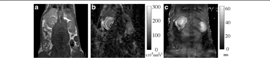 Fig. 1 Representative MRI images. Typical images from a) T2-weighted anatomical scan, with corresponding b) ADC map and c) T2* map from amatched slice, including example ROIs to indicate the selections for analysis of renal cortex and medulla