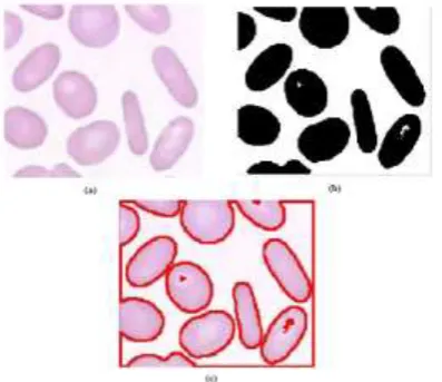 Figure 3:  (a) :Original image of Enlarged RBC (b)Binarized image (c) Segmented   image  