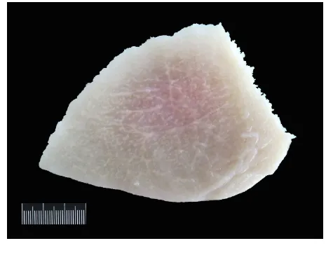 Figure 1. Case No. 3. Transverse section of a formalin-fixed pectoral muscle. Evident