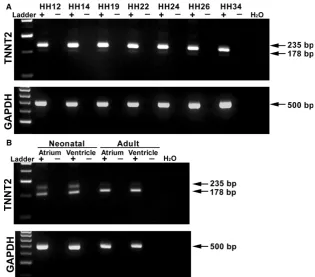 Fig. 1 mRNA expression ofembryonic, neonatal and adult chick heart.PCR products obtained using a primer pairdesigned around the exon 5, which isalternately spliced in TNNT2 in the TNNT2