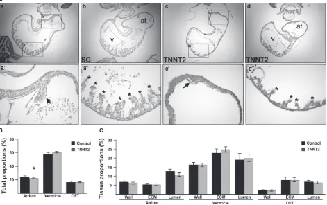 Fig. 4 TNNT2-treated embryos undergo abnormal atrial septation and trabecular formation, and the atrial chamber is reduced in size