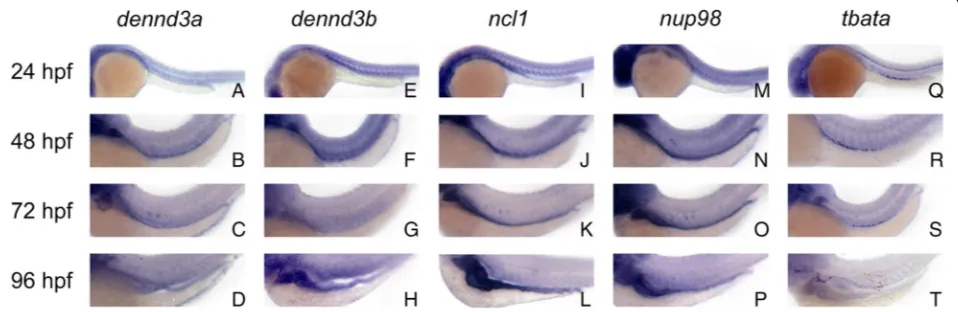 Fig. 2 Temporal and spatial expression patterns of zebrafish orthologs. Whole mount in situ hybridized embryos hybridized with antisenselateral views