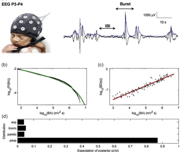 Fig. 5. Critical statistics in neonatal hypoxic ischemic encephalopathy. (a) Scalp EEG channels show characteristic bursting pattern of activity with bursts erratically punctuating a ﬂat EEG trace