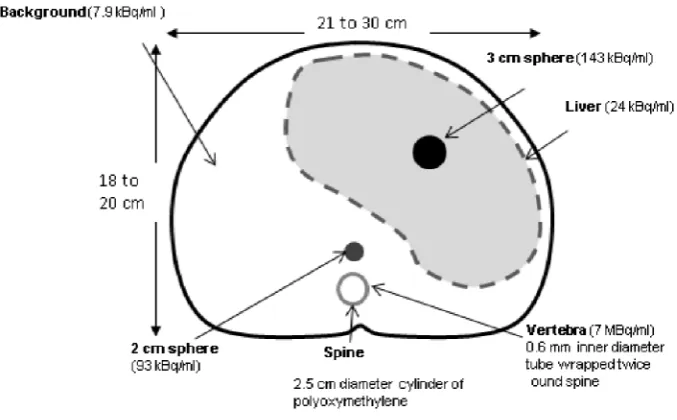Figure 2. A cross-section of the abdomen-shaped phantom. The positions and activity concentrations of the fillable inserts are shown