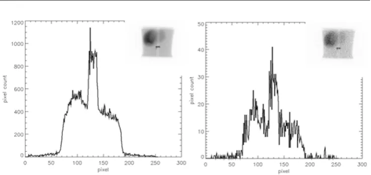Figure 3. An example of a high count image prior to Poisson resampling left, with a profile through the insert image overlaying the spine to mimic one active vetebra