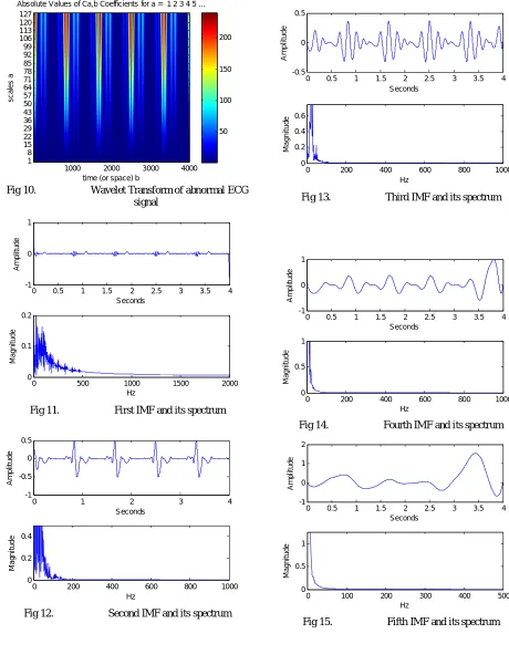 Fig 10.time (or space) b Wavelet Transform of abnormal ECG signal 