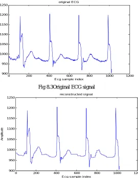 Fig 8.4Reconstructed  ECG signal after compression using db1 wavelet 