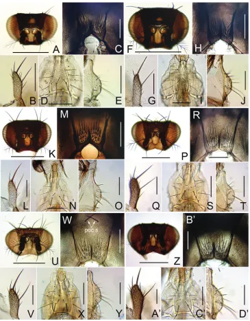 Figure 4. Head (anterior view), postocciput, palpus, and prementum (ventral and lateral view, respectively)