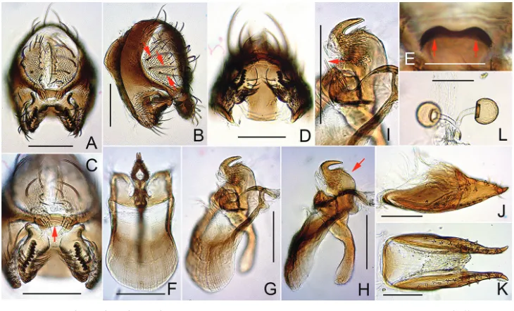 Figure 6. Dichaetophora heterochroma sp. n. (A−I #03879 J−L paratype #03881). A, B Periphallic organs (posterior and posterolateral view, respectively) C surstyli and cerci, with red arrow indicating the cau-doventral bridge of cerci D, E tenth sternite (v