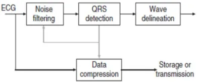 Figure 1 Algorithms for basic ECG signal processing. 
