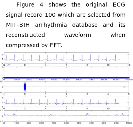 Figure 4 shows the original ECG 