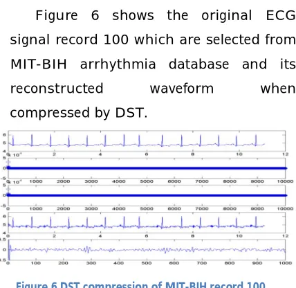 Figure 6 shows the original ECG 