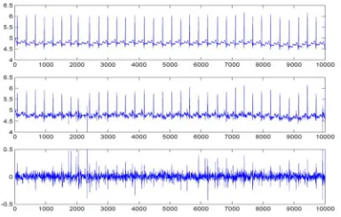 Figure 7 shows the original ECG signal record 100 which are selected from MIT-BIH arrhythmia database and its reconstructed waveform when compressed by DCT-II