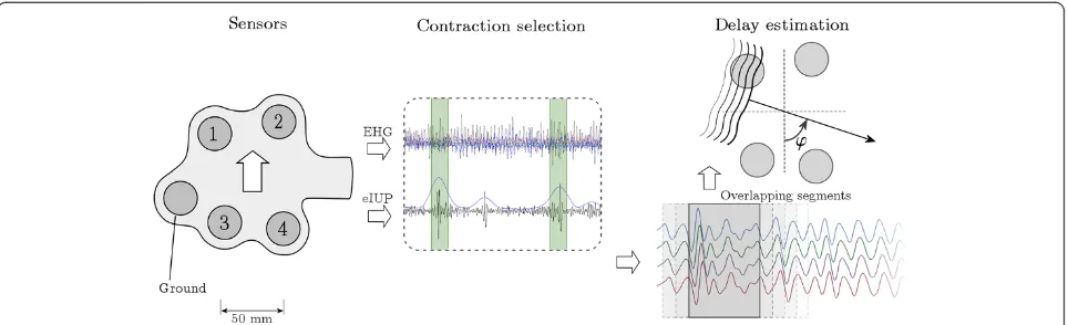 Figure 2 The method for analyzing the EHG CV. The EHG is recorded using a fixed configuration of four electrodes plus ground and referenceelectrodes