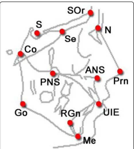 Fig. 1 Cephalometric Landmark Points