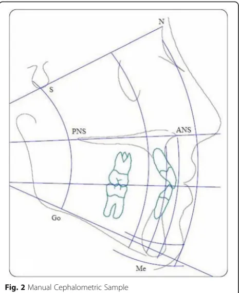 Fig. 2 Manual Cephalometric Sample