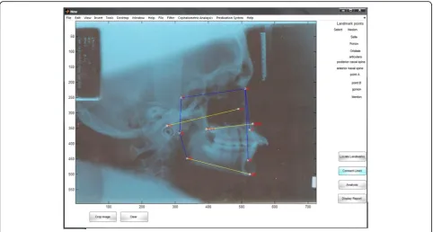 Table 1 Cephalometric parameters used in this study
