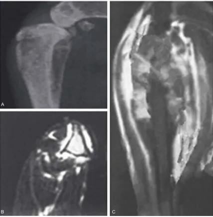 Figure 1. X-ray detection of tibia surrounding tissue pathology characteristics. A. First week, normal tibia structure; B