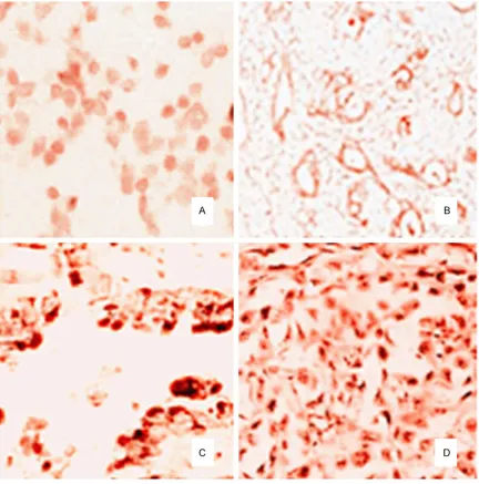 Figure 2. Immunohistochemical detection of Bcl-2 expression in different organs. A. Bcl-2 highly expressed in lung tissue (×200)
