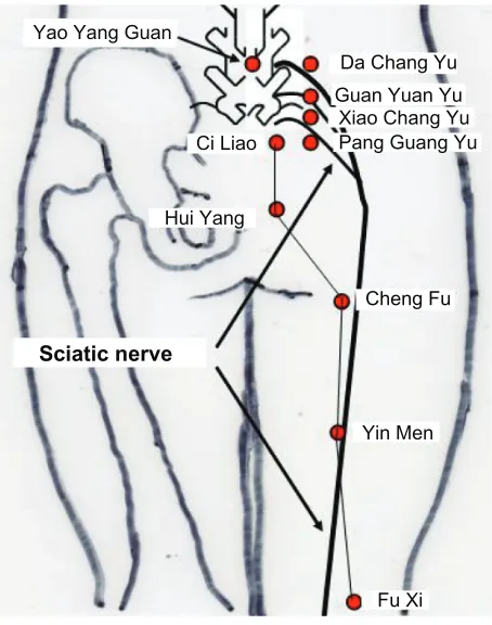 Figure 1 the sciatic nerve and some acupuncture points.