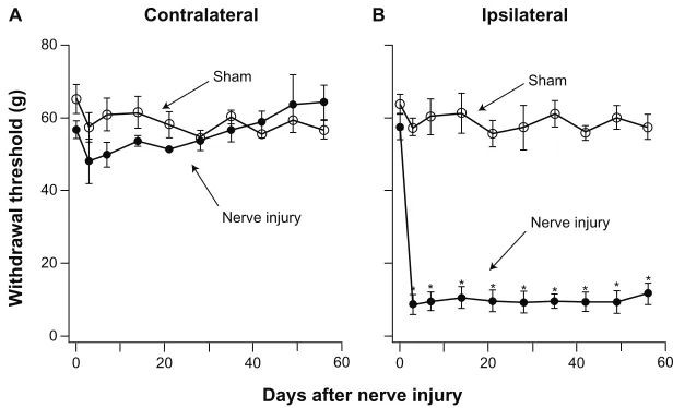 Figure 2 Sheep hindlimb withdrawal thresholds.Notes: In pre-injury sheep, withdrawal thresholds were determined 1–2 weeks prior to surgery (n = 6). There was no significant difference between ipsilateral and contralateral hindlimbs