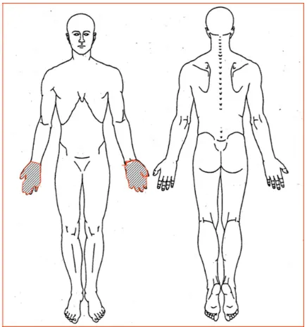 Figure 1 The pain drawing used for this study.