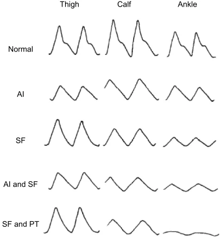 Table 2 PVR is classified into five categories that are combined with pressure data to define states of vascular disease