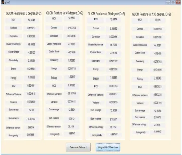 Figure 4 Gray level co-occurrence matrix (GLCM) features computed at D=1.