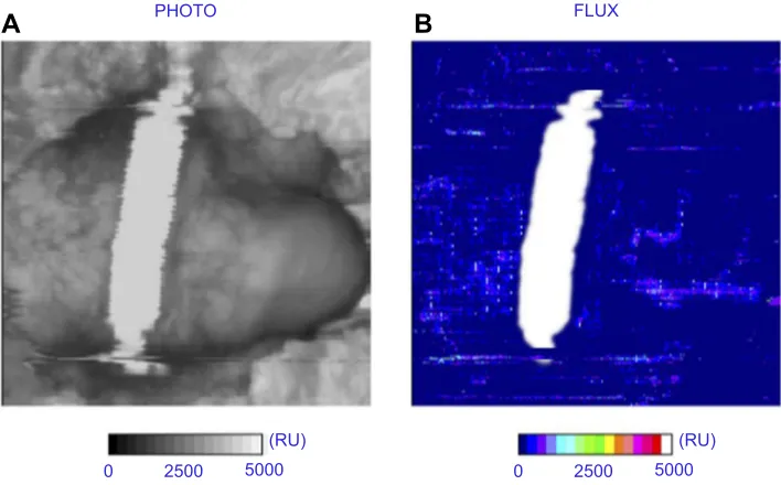 Figure 5 The Dribblestop penile compression device (PCD) had, by 60 mins wear time, decreased distal blood perfusion ﬂux (Figure 4) after an initial rise corresponding toa sustained increase in interfacial pressure (Figure 3)