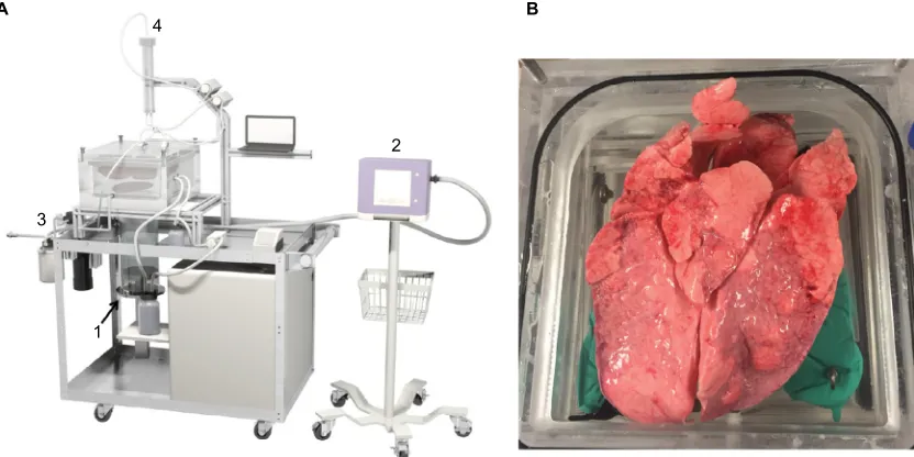 Figure 1 (A) Schematic of the ex vivo lung chamber consisting of (1) piston to enable precise control of negative pressure ventilation, (2) clinical ventilator-controlled PPV, (3) compressor and positive end-expiratory pressure valve maintained a set compliance in the chamber to allow PPV, and (4) leak quantification system including air collection cylinder, air removal pump, recirculation pump, and ultrasonic level sensor; (B) image of lungs in the chamber with trachea cannulated (behind upper lobes).Abbreviation: PPV, positive pressure ventilation.